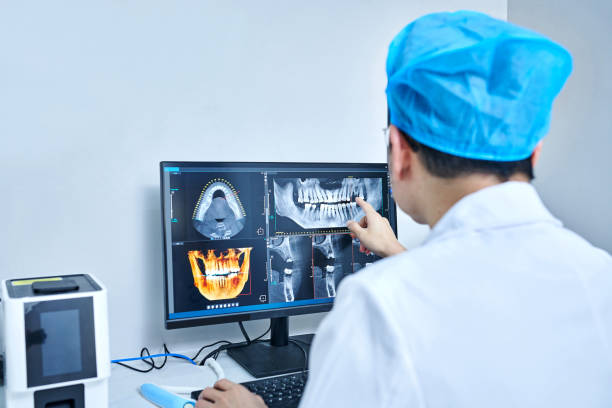 Best Emergency Dentist for Lost Fillings or Crowns in East Newark, NJ